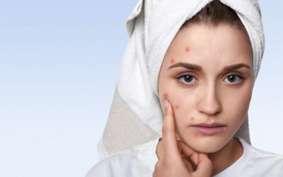 Banish Pimples After Waxing: Simple Prevention Tips