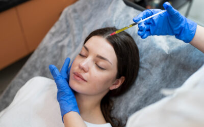 Microneedling Essentials: Here’s What You Need to Know